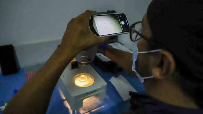 INIA autorizado para producir semen caprino de calidad