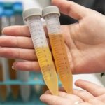 Lactosuero De residuo a ingrediente de alto valor