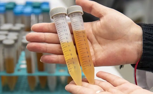 Lactosuero De residuo a ingrediente de alto valor